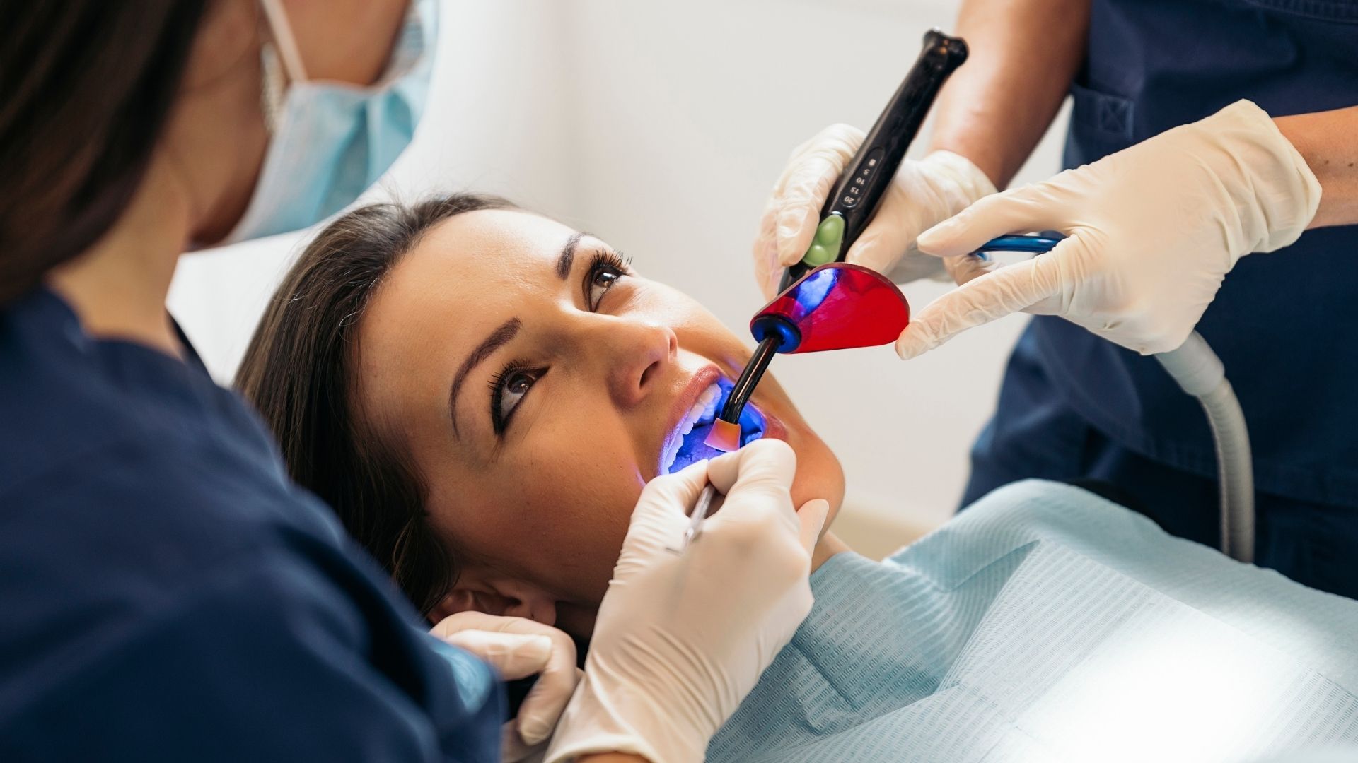 Dental Fillings in Udaipur