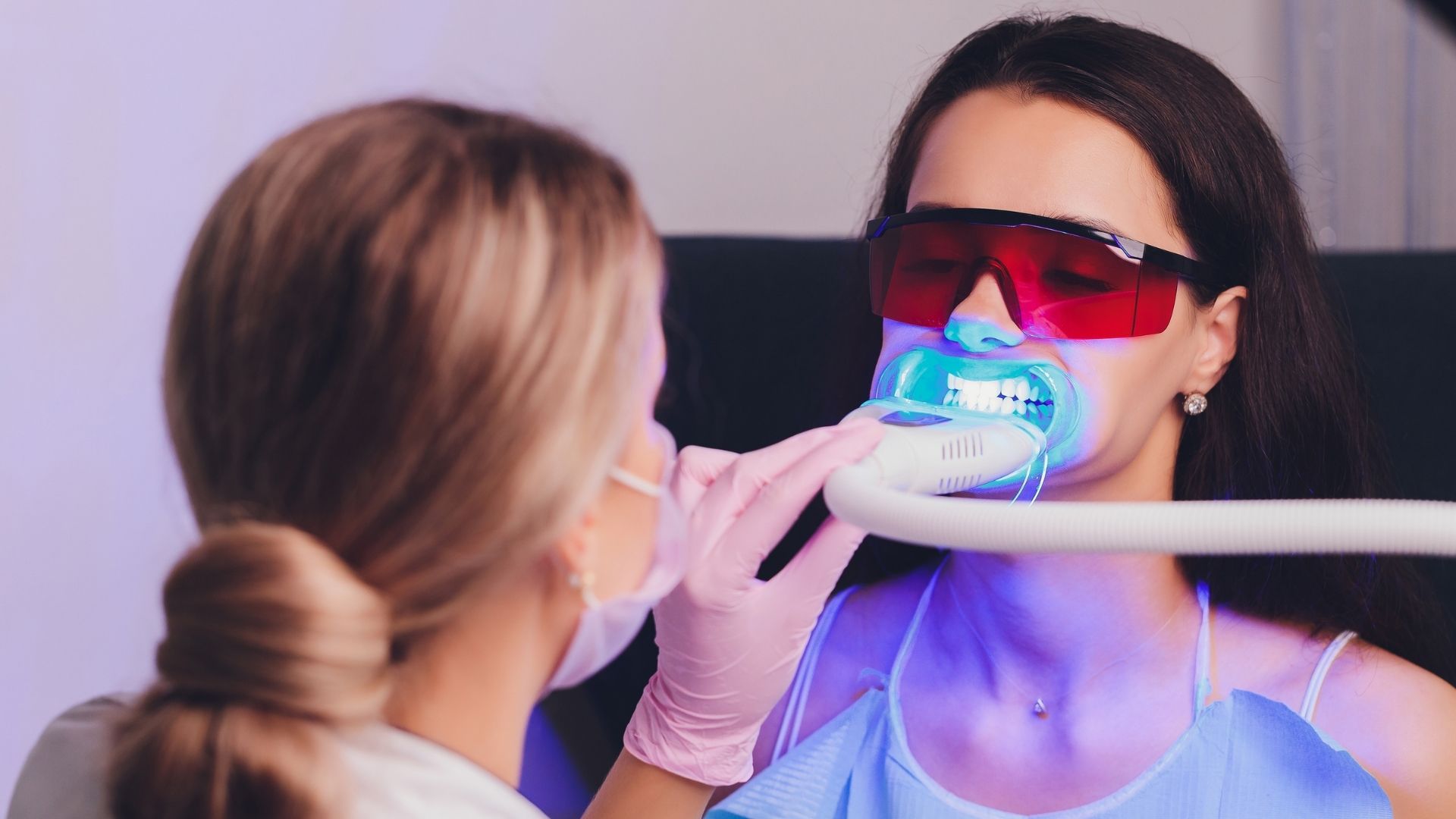 Teeth Whitening in Udaipur Teeth Bleaching in Udaipur